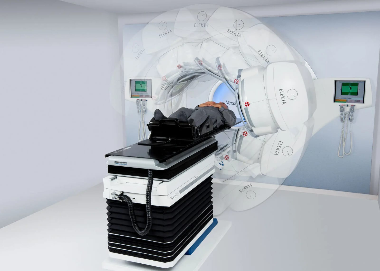 acceleratore lineare