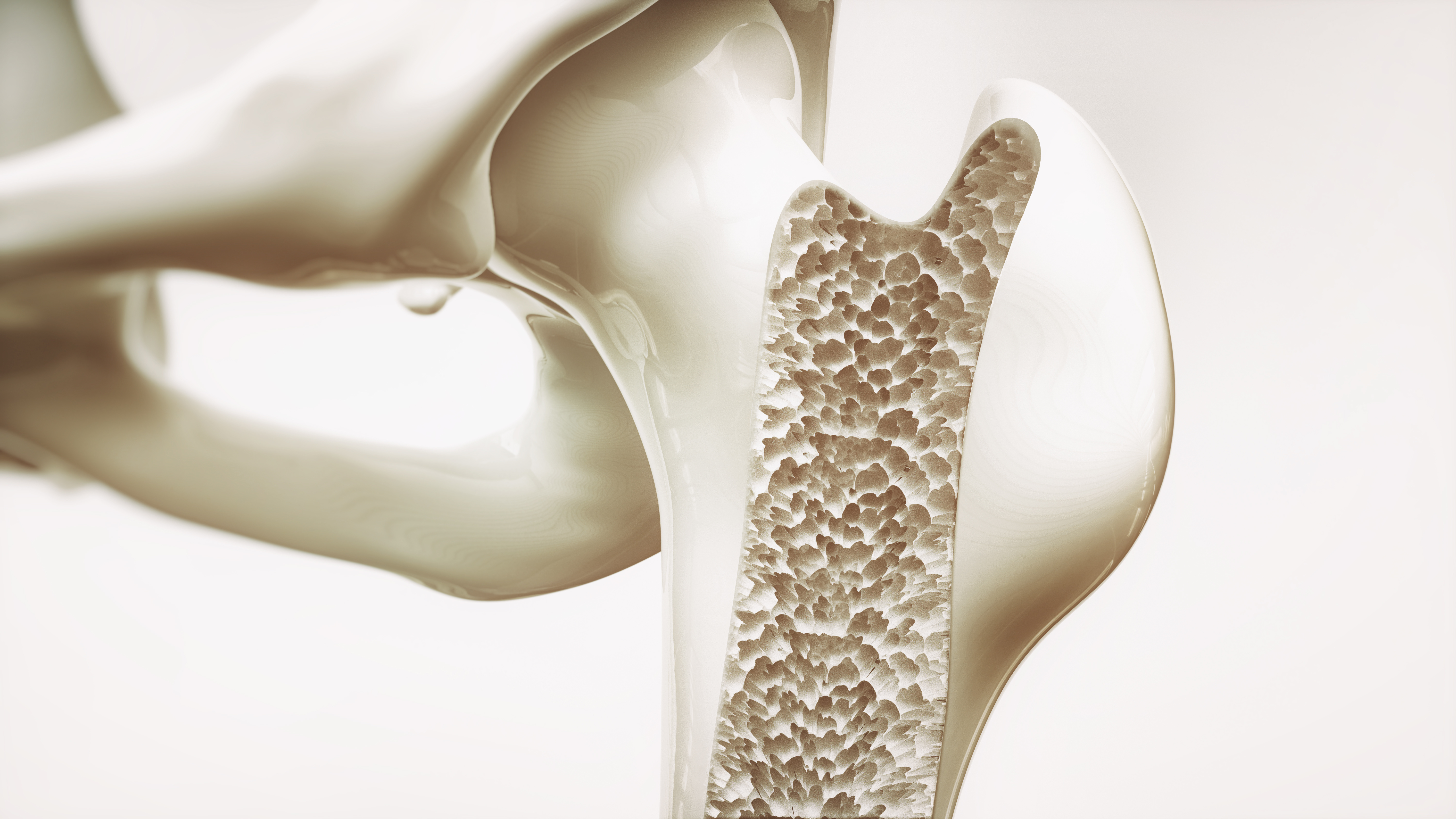 osteoporosi